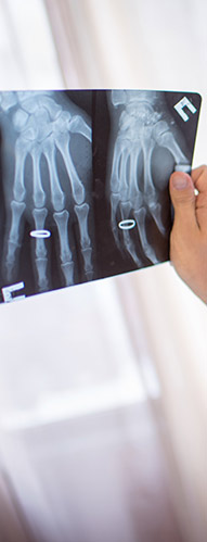 chirurgie ruky Praha